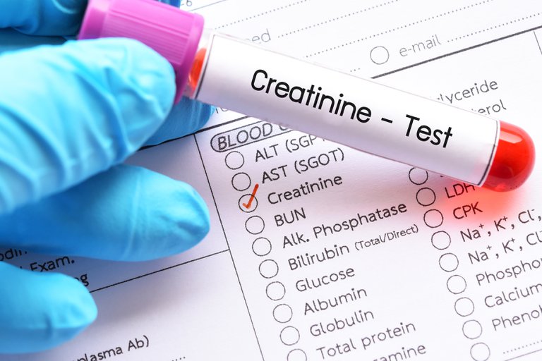  Pacientes con incremento de creatinina tienen mayor riesgo de mortalidad por COVID-19