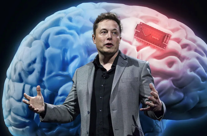  Elon Musk implanto su primer chip en cerebro humano